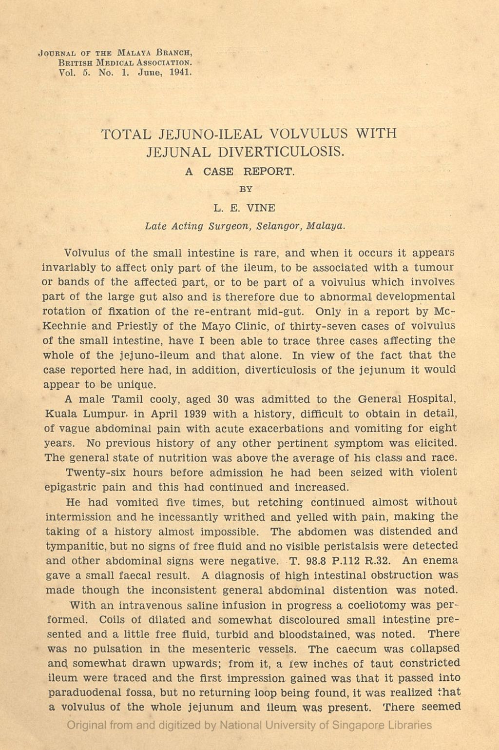 Miniature of Total jejuno-ileal volvulus with jejunal diverticulosis