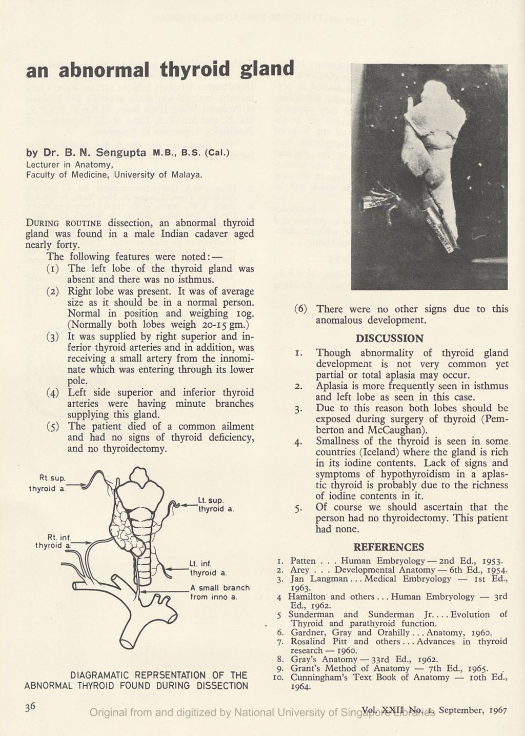 Miniature of Abnormal Thyroid Gland