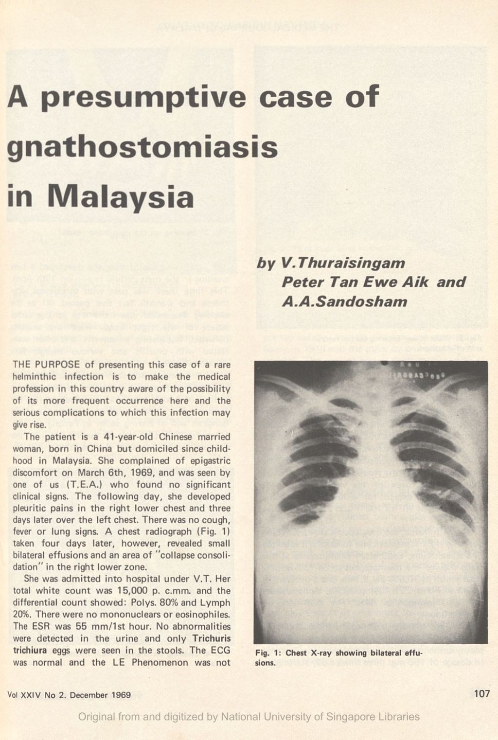 Miniature of presumptive case of gnathostomiasis in Malaysia