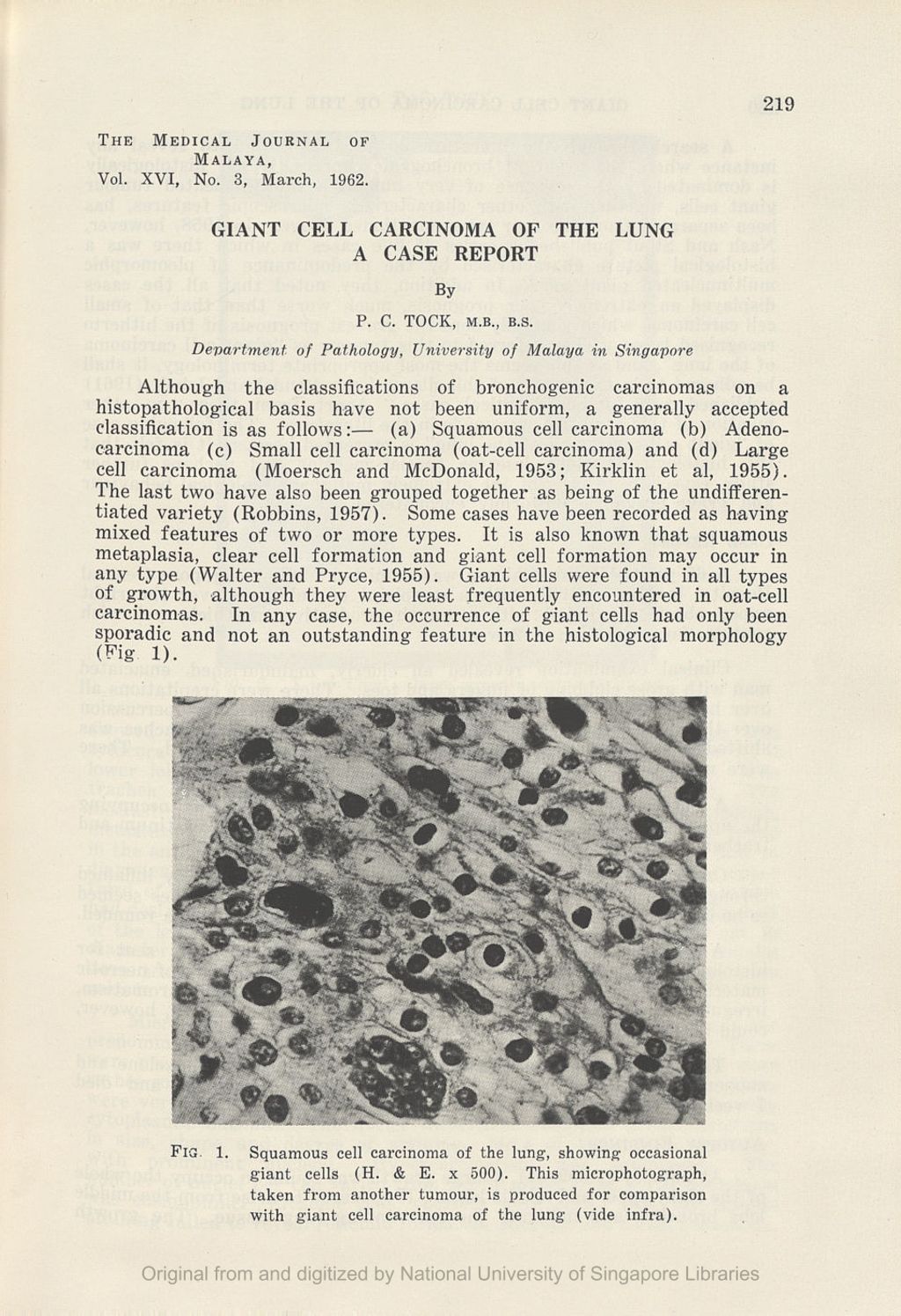 Miniature of Giant Cell Carcinoma Of The Lungâ€” A Case Report