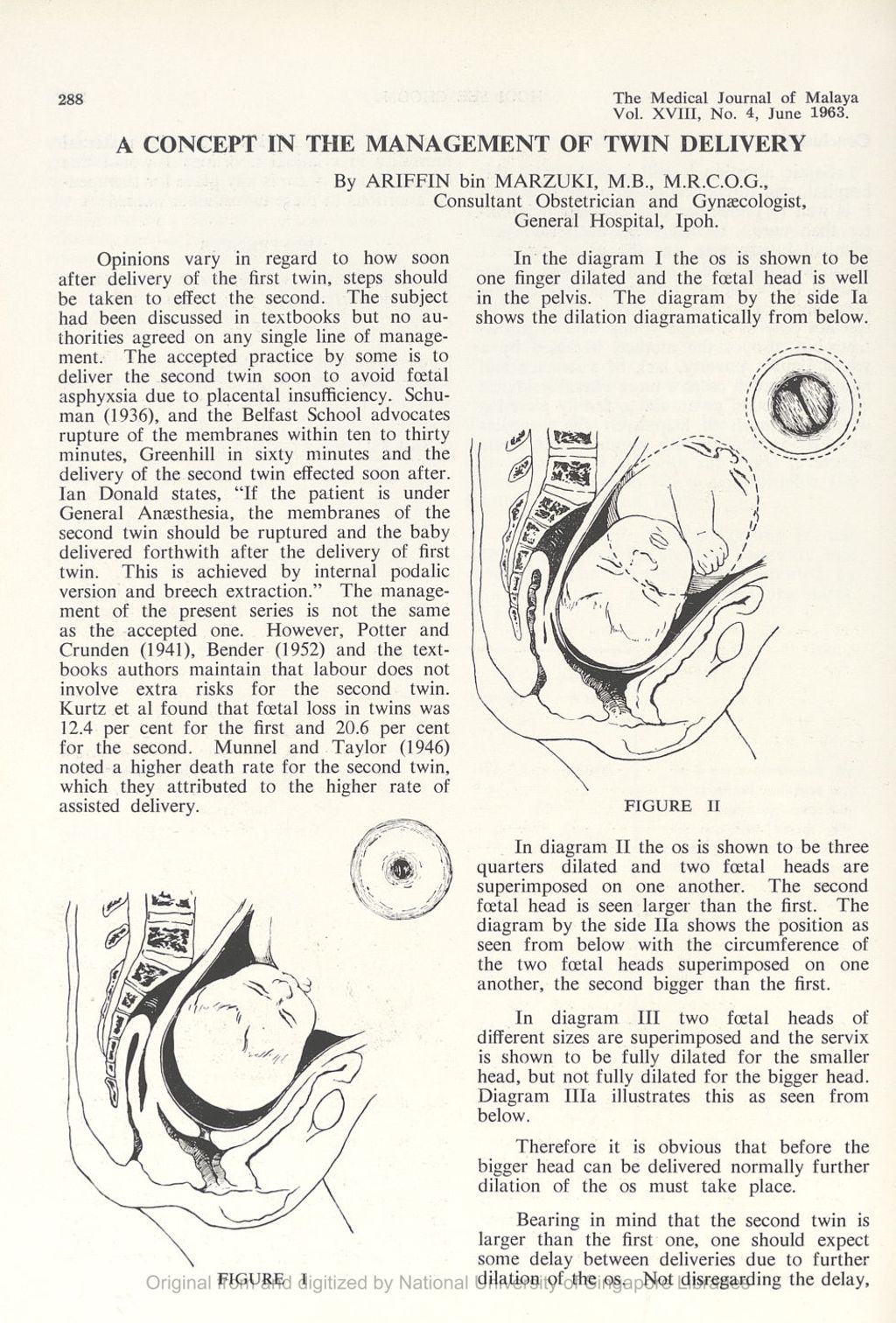 Miniature of Concept In The Management Of Twin Delivery